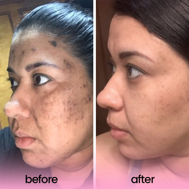 Kojic Acid & Turmeric Cleansing Pads (Original)